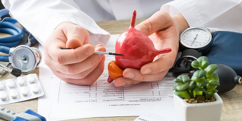 প্রাথমিকভাবে, মূত্রাশয় ক্যান্সারের জন্য অস্ত্রোপচার হল সবচেয়ে নির্ভরযোগ্য চিকিৎসা